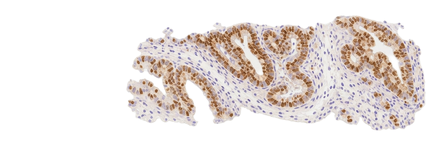 Immunohistochemistry stained histology slide
