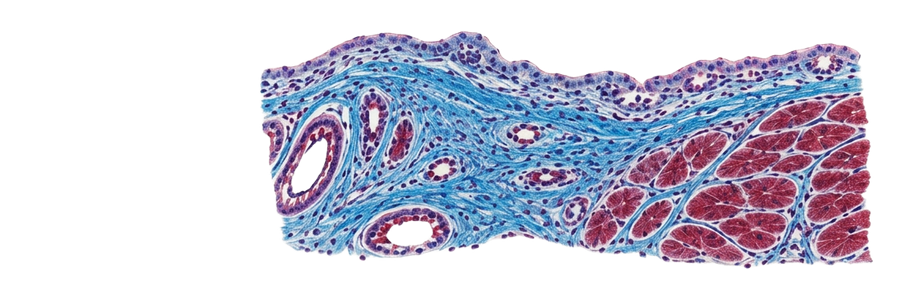 Masson trichrome stained histology slide